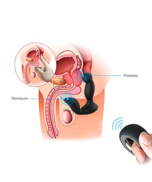 Anal Control Massageador de Próstata com controle remoto - Intt